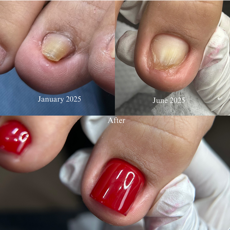 Pedicure Services