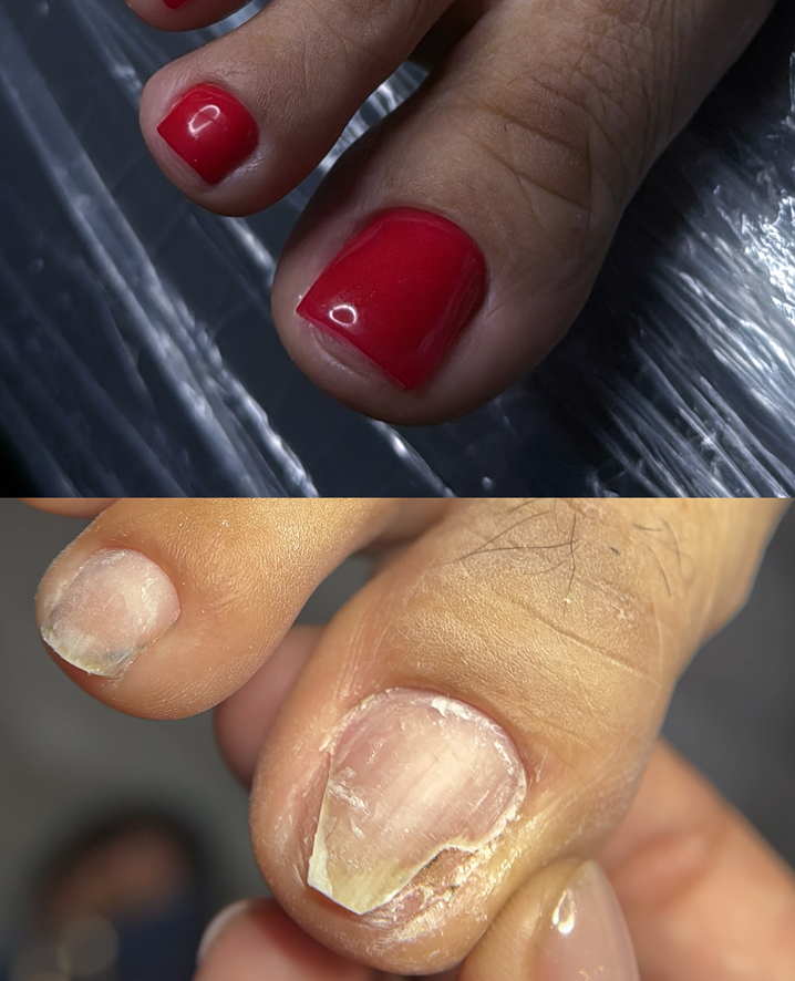 Pedicure Services